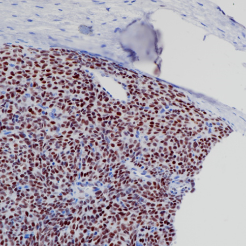 TLE1 Rabbit Monoclonal Antibody(ARB562)