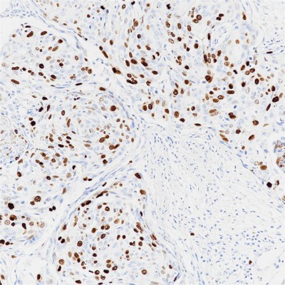 TPO Rabbit Monoclonal Antibody(ARB564)