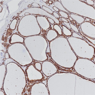 TPO Mouse Monoclonal Antibody(ARB565)