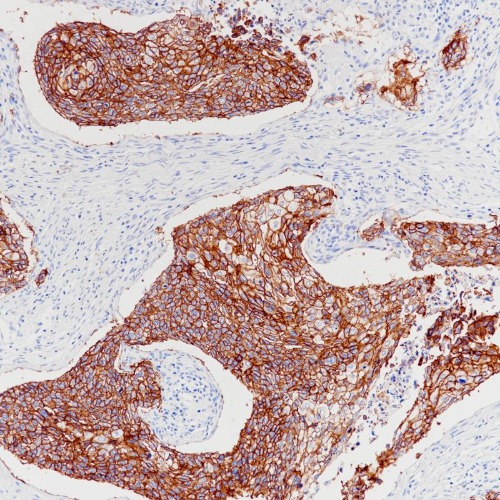TROP-2 Rabbit Monoclonal Antibody(ARB566)