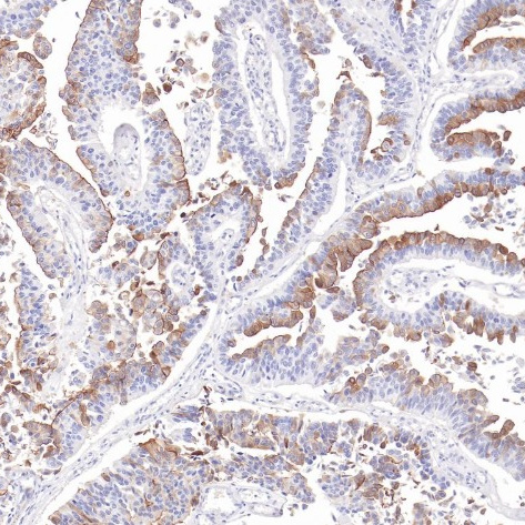 Uroplakin 1a（UPK1A) Rabbit Monoclonal Antibody(ARB567)