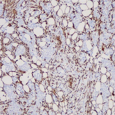Vimentin Rabbit Monoclonal Antibody(ARB570)