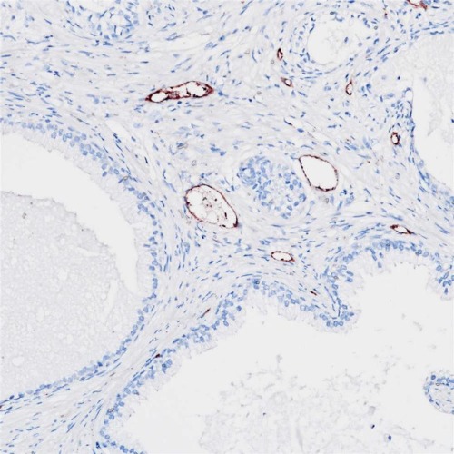 Von Willebrand Factor(VWF) Rabbit Monoclonal Antibody(ARB571)