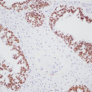 WT1 Rabbit Monoclonal Antibody(ARB572)