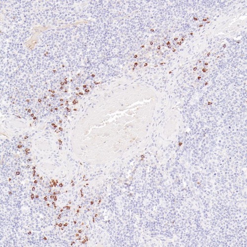 IgG4 Rabbit Monoclonal Antibody(ARB575)