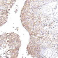 Uroplakin 1b(UPK1B) Rabbit Monoclonal Antibody(ARB576)