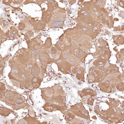 Tyrosine Hydroxylase Rabbit Monoclonal Antibody(ARB577)