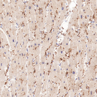 FABP3 Rabbit Monoclonal Antibody(ARB579)