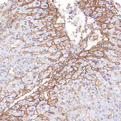 Carbonic Anhydrase 14 Rabbit Monoclonal Antibody(ARB580)