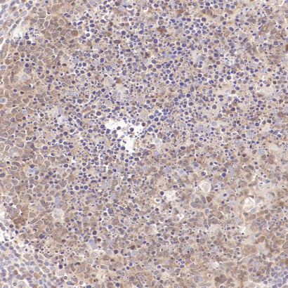 Caspase-3 Rabbit Monoclonal Antibody(ARB583)