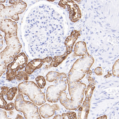 Carbonic Anhydrase 12 Rabbit Monoclonal Antibody(ARB584)