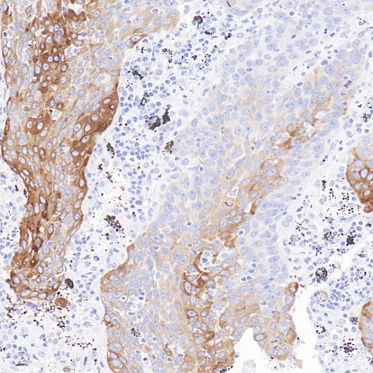 HER3 Rabbit Monoclonal Antibody(ARB585)