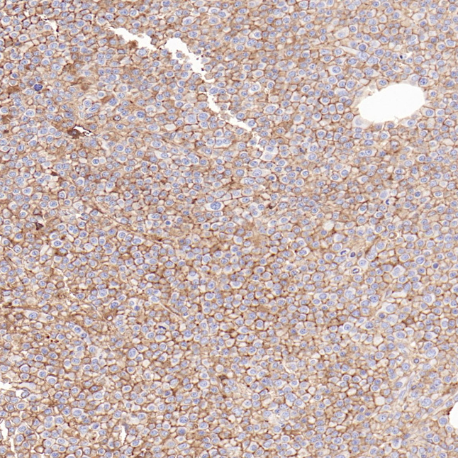 CD138 Rabbit Monoclonal Antibody(ARB586)