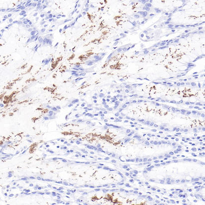 Helicobactor pylori Rabbit Monoclonal Antibody(ARB587)