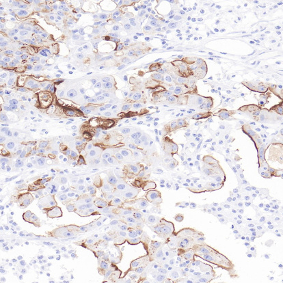 SLC34A2 Rabbit Monoclonal Antibody(ARB589)