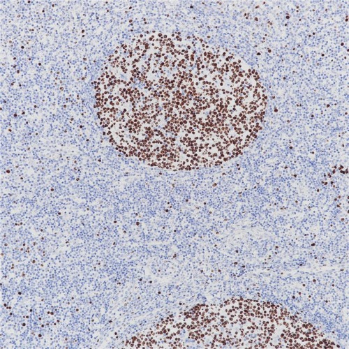 Ki-67 Rabbit Monoclonal Antibody(ARB590)