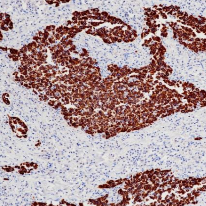 CK5&6 Rabbit Monoclonal Antibody(ARB591)