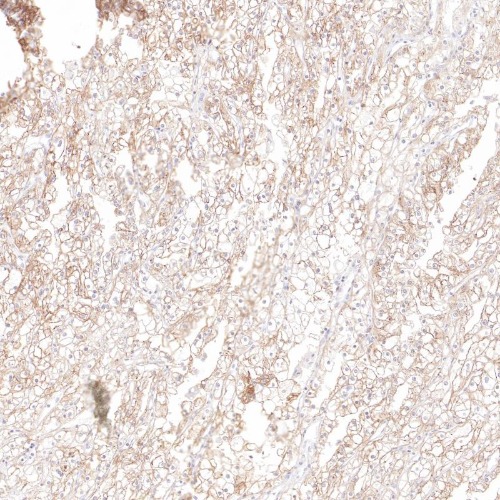 CD70 Rabbit Monoclonal Antibody(ARB592)