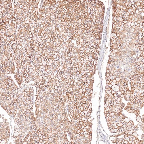 Cadherin 16 Rabbit Monoclonal Antibody(ARB593)
