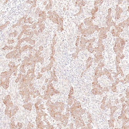 Mesothelin Rabbit Monoclonal Antibody(ARB594)