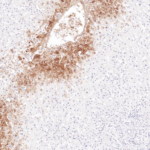 GS Rabbit Monoclonal Antibody(ARB596)