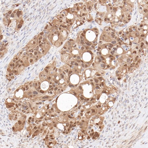GST-&pi; Rabbit Monoclonal Antibody(ARB597)