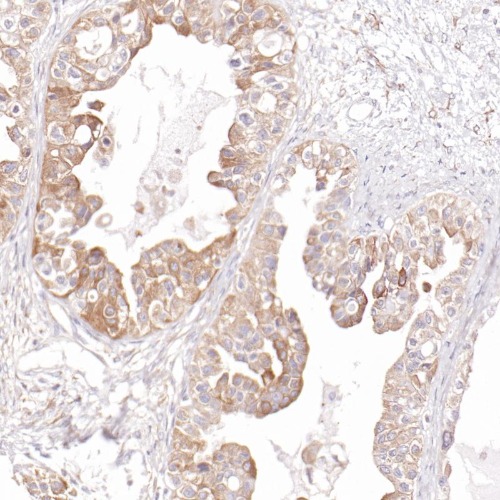 LRP Rabbit Monoclonal Antibody(ARB598)