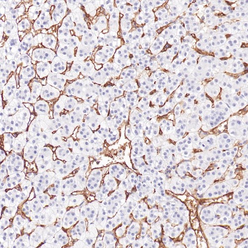 CD105 Rabbit Monoclonal Antibody(ARB599)