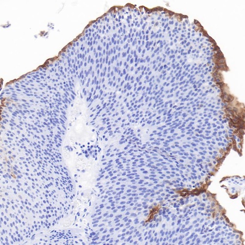 Uroplakin II Rabbit Monoclonal Antibody(ARB600)